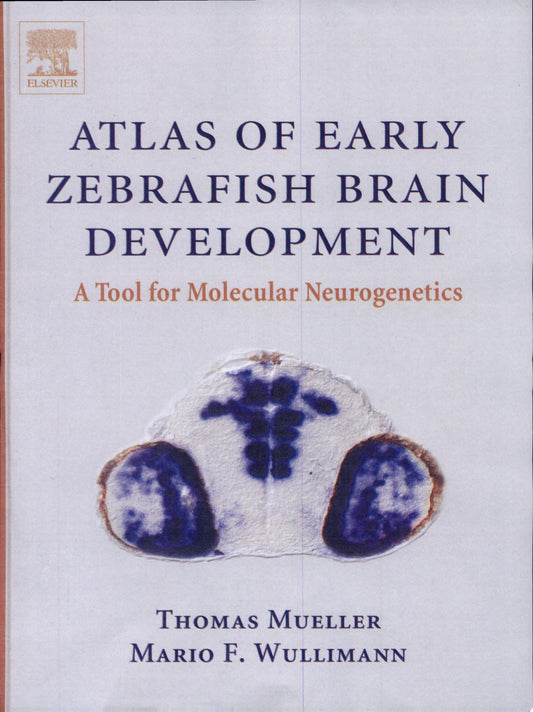 Atlas of Early Zebrafish Brain Development: A Tool for Molecular Neurogenetics